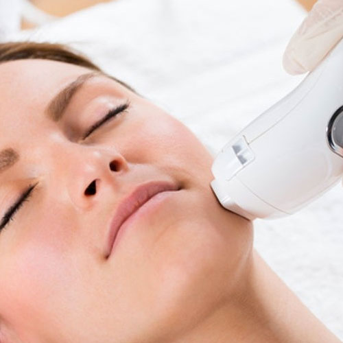 Laser Facials in Gainesville FL
